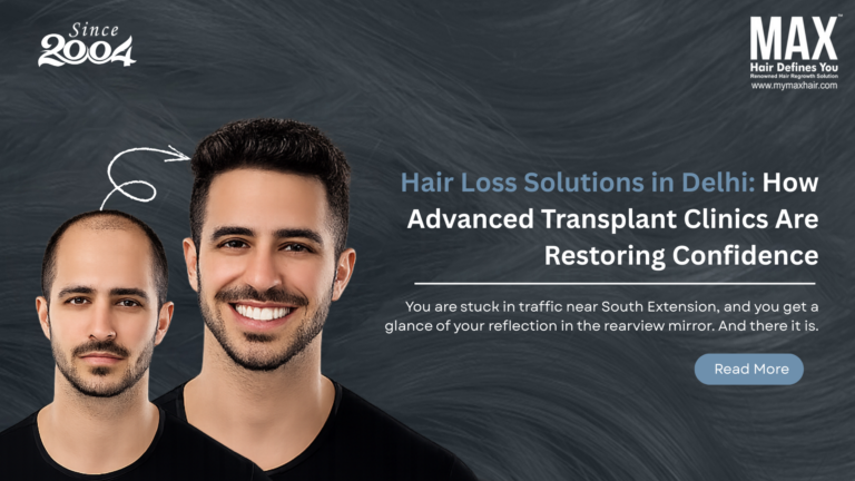 Hair Loss Solutions in Delhi How Advanced Transplant Clinics Are Restoring Confidence