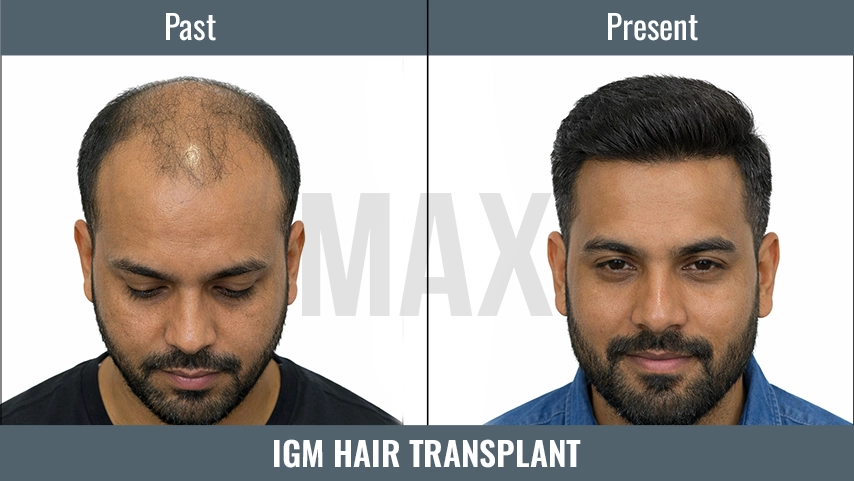 IGM Hair