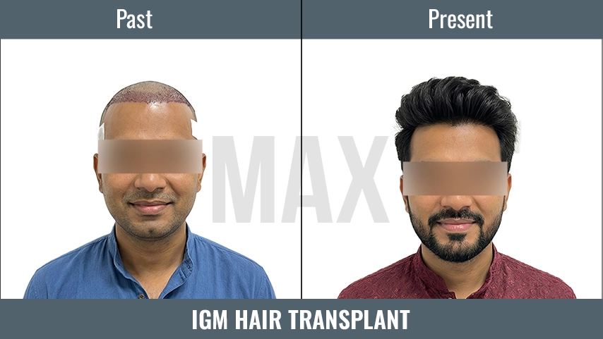 IGM Hair
