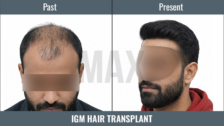 IGM Hair=