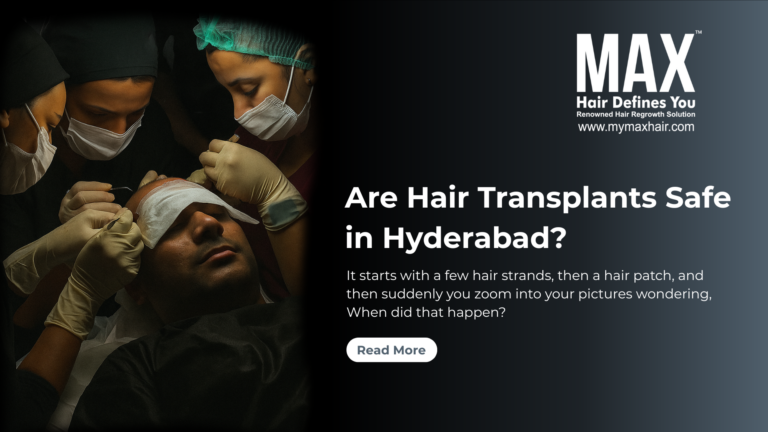 Are Hair Transplants Safe in Hyderabad