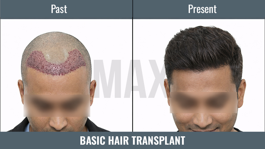 BASIC HT