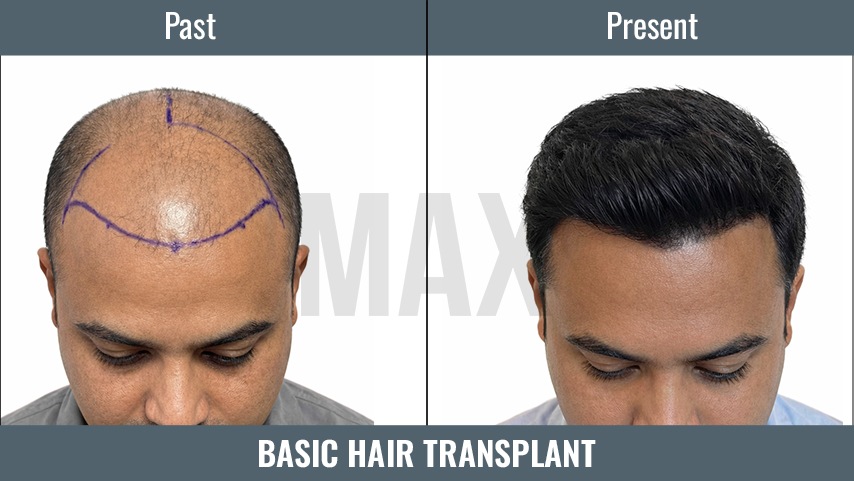 BASIC HT 3