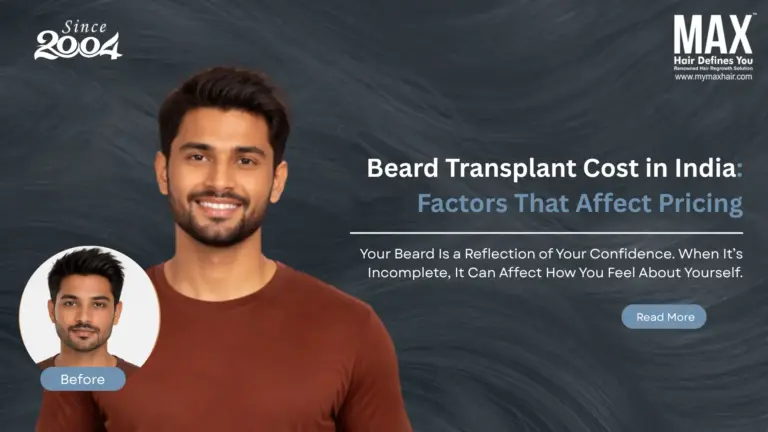 Beard Transplant Cost in India: Factors That Affect Pricing