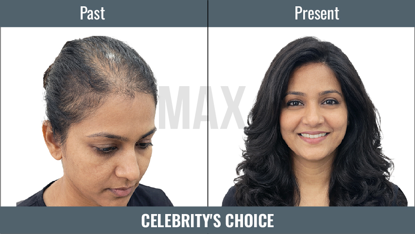 Celebrity's Choice 2