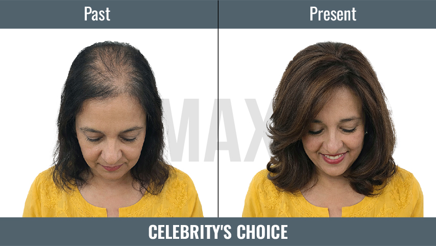 Celebrity's Choice 3