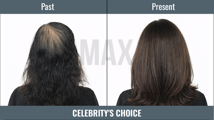 Celebrity's Choice