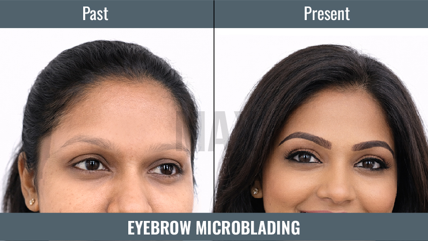 Eyebrow Microblading 2