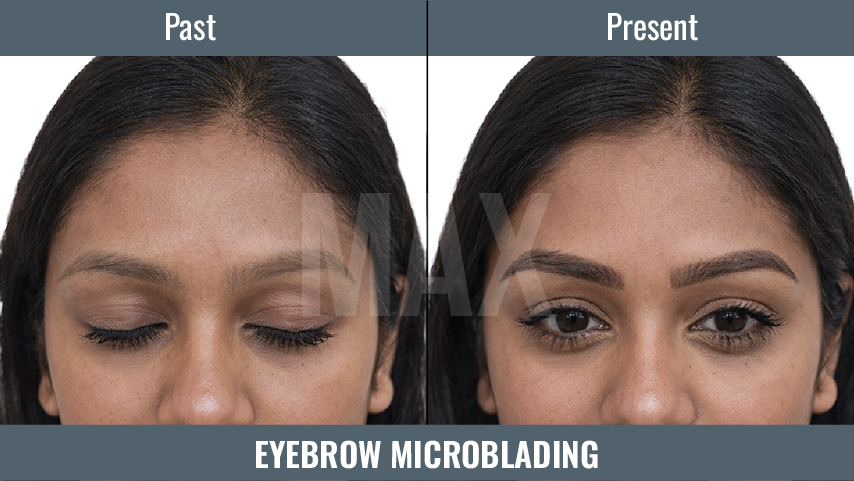 Eyebrow Microblading