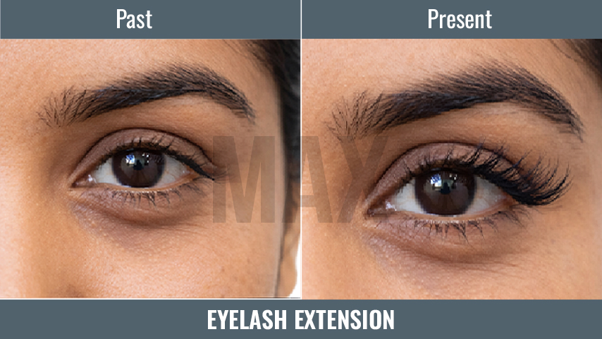 Eyelash Extension