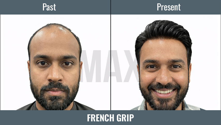 FRENCH GRIP 2