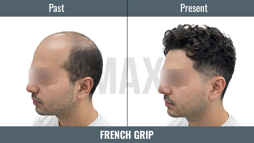 FRENCH GRIP 3