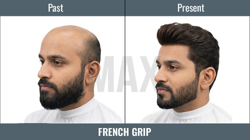 FRENCH GRIP