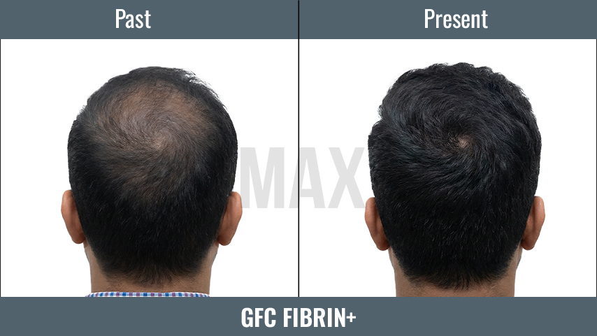 GFC