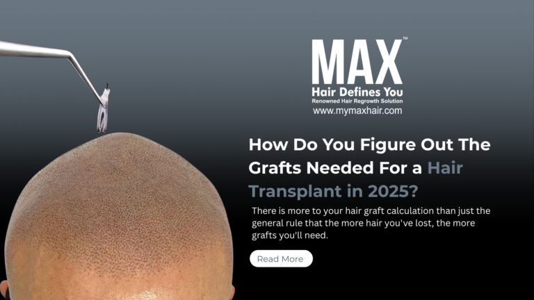 hair transplant