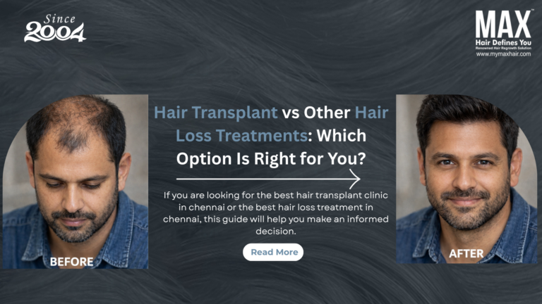 Hair Transplant vs Other Hair Loss Treatments: Which Option Is Right for You?