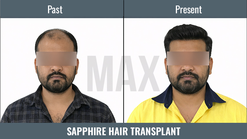 SAPPHIRE HT