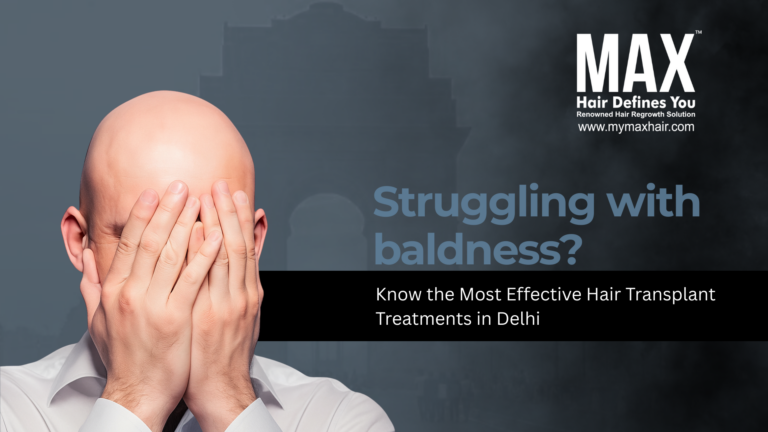 Struggling with baldness