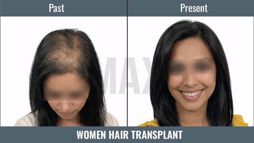 WOMEN HT