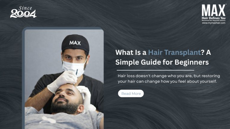 What Is a Hair Transplant? A Simple Guide for Beginners