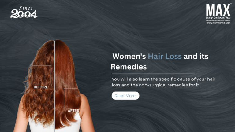 Women's hair loss and its remedies