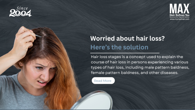 Worried about hair loss? Here’s the solution