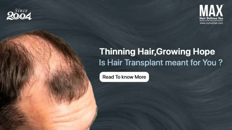 Is Hair Transplant the Right Solution for Thinning Hair?
