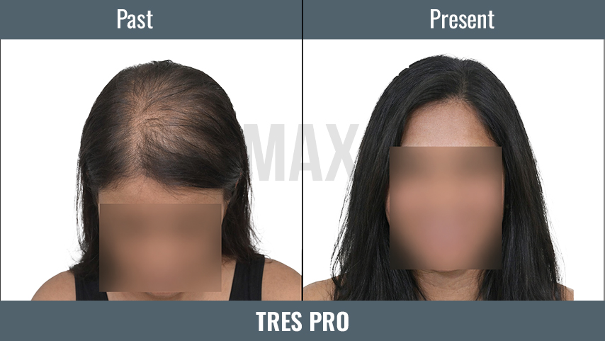 tres pro