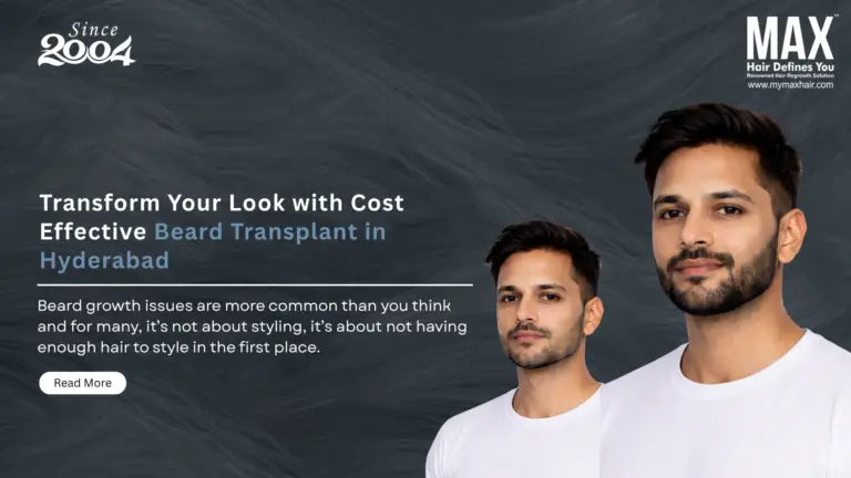 Transform Your Look with Cost Effective Beard Transplant in Hyderabad