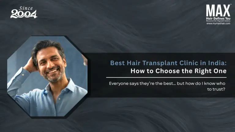 Best Hair Transplant Clinic in India