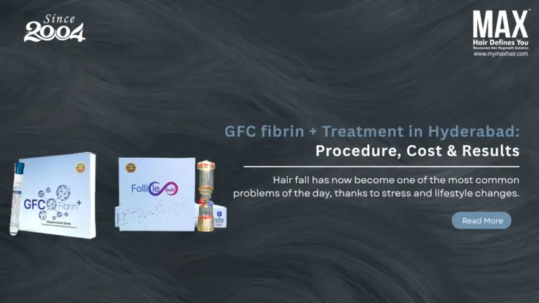 GFC fibrin + Treatment in Hyderabad