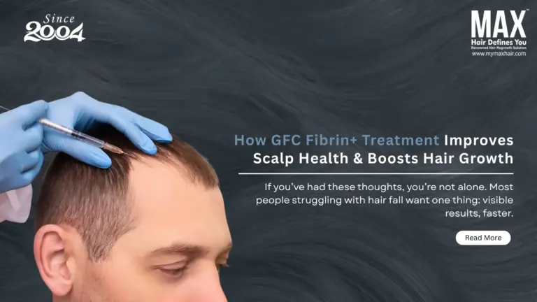 How GFC Fibrin+ Treatment Improves Scalp Health & Boosts Hair Growth