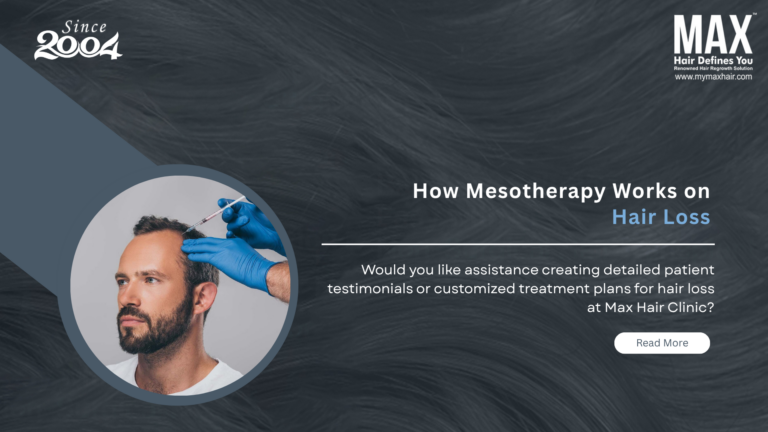 Best Hair Replacement Solution in Chennai