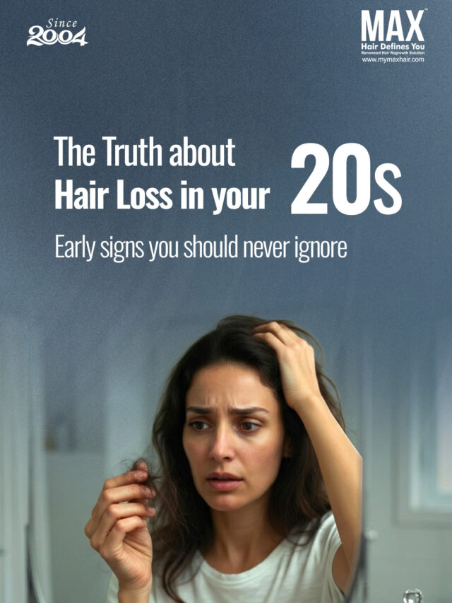best hair transplant clinic in chennai
