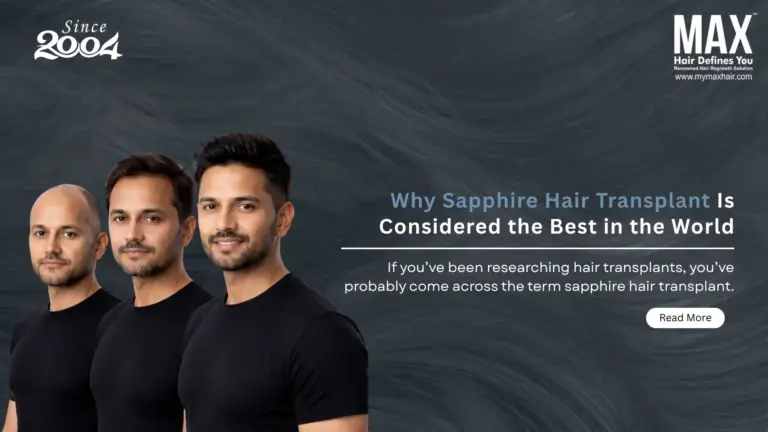 Why Sapphire Hair Transplant Is Considered the Best in the World