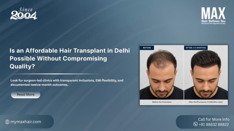 Affordable Hair Transplant in Delhi