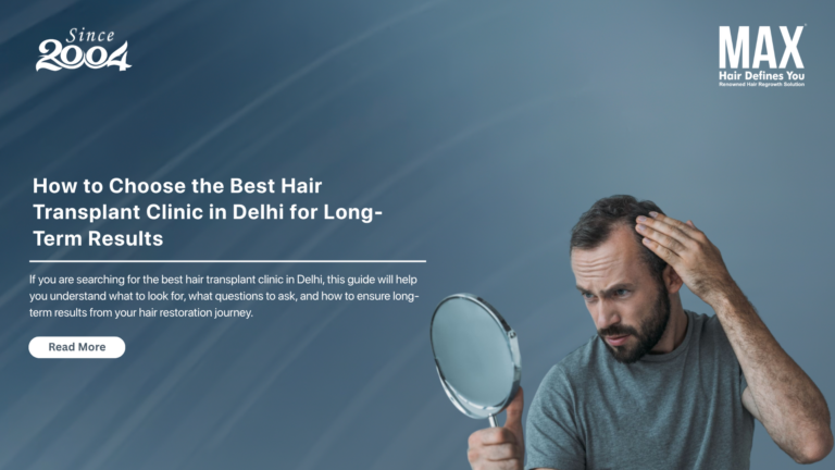 Best Hair Transplant Clinic in Delhi