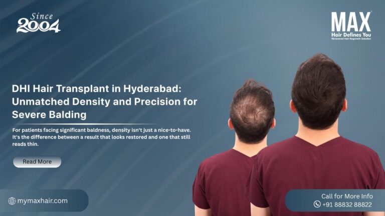 DHI Hair Transplant in Hyderabad