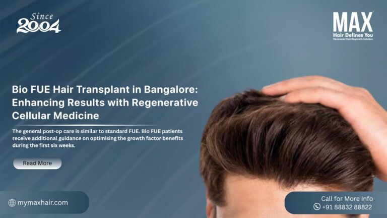FUE Hair Transplant in Bangalore