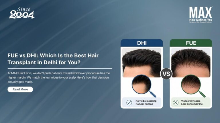 FUE vs DHI Which Is the Best Hair Transplant in Delhi