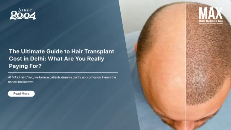 Guide to Hair Transplant Cost in Delhi