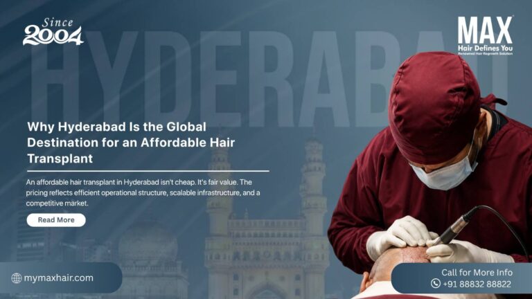 Hyderabad Is the Global Destination for an Affordable Hair Transplant