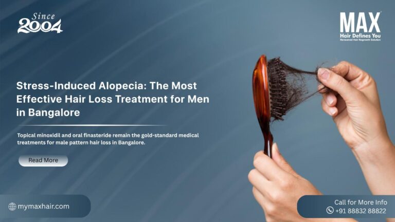 The Most Effective Hair Loss Treatment for Men in Bangalore