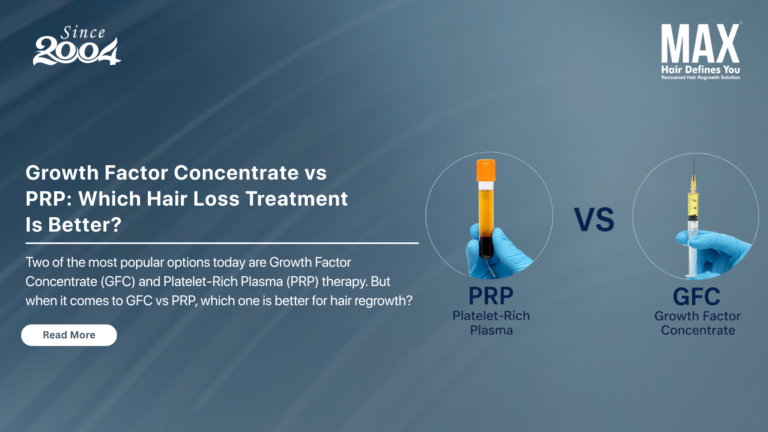 Which Hair Loss Treatment Is Better