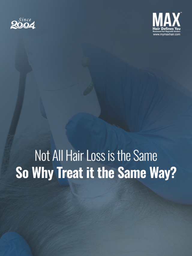 best hair transplant clinic in chennai