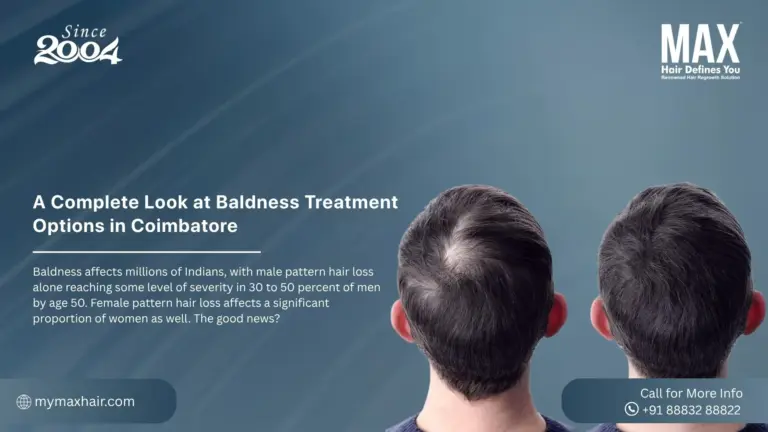 Baldness Treatment Options in Coimbator
