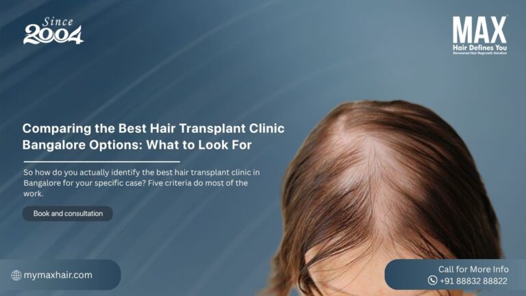 Comparing the Best Hair Transplant Clinic Bangalore Options