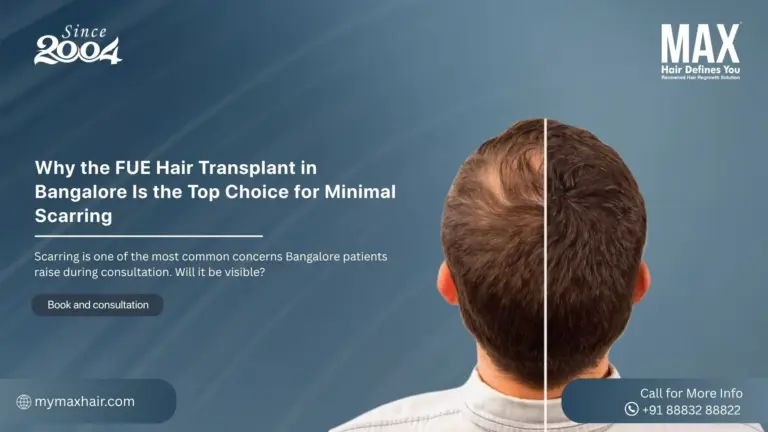 FUE Hair Transplant in Bangalore Is the Top Choice for Minimal Scarring