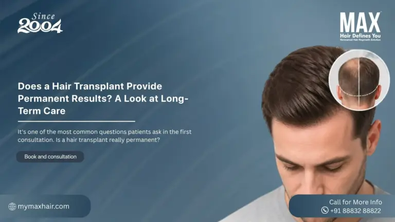 Is a hair transplant really permanent