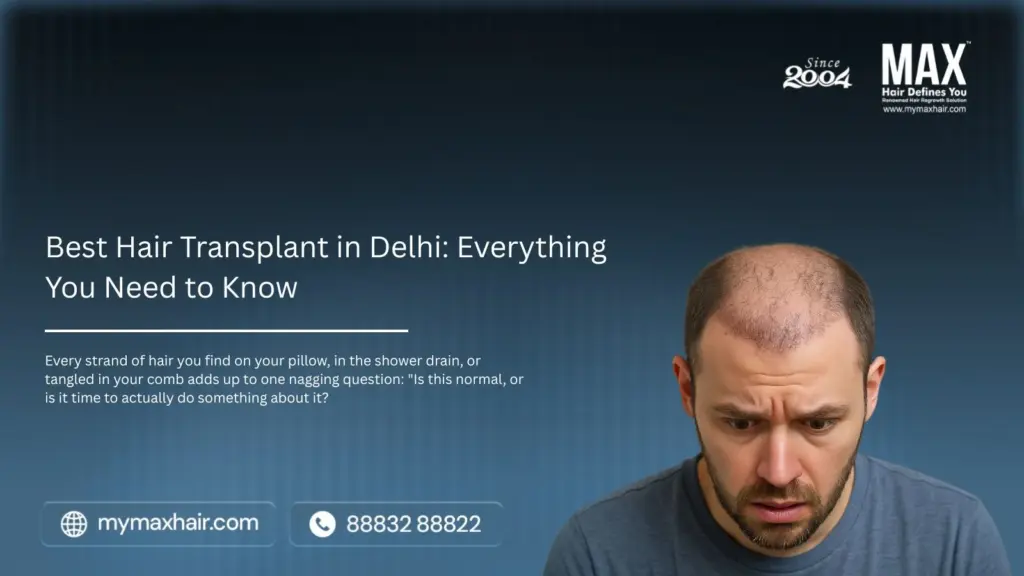 Hair Transplant in Delhi Everything